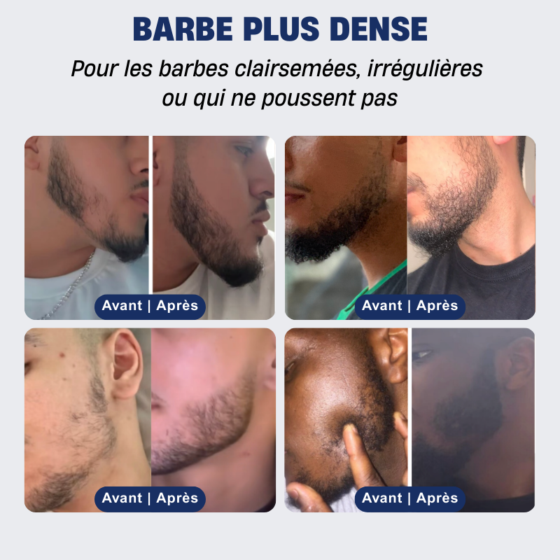 la-douce-barbe-coffret-barbe-douce-complet-kit-barbe image 3