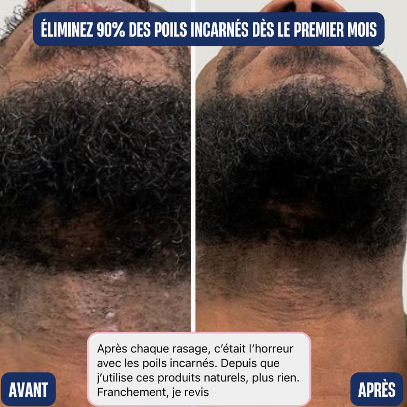 la-douce-barbe-gommage-visage-et-barbe-exfoliant-naturel image 4