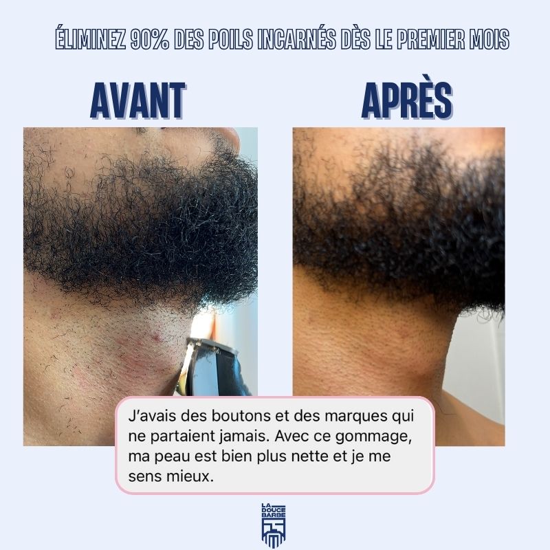 la-douce-barbe-brosse-exfoliante-barbe-visage-cheveux image 2
